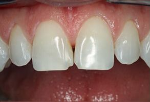 Glowing Smile Dental Studio | Periodontal Treatment, Night Guards and Oral Cancer Screening